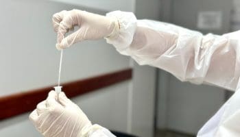 50 mil kits de testagem de Covid-19 estão disponíveis em Goiânia durante carnaval