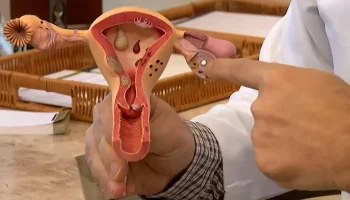 Endometriose: conheça os sintomas e saiba como tratar a doença