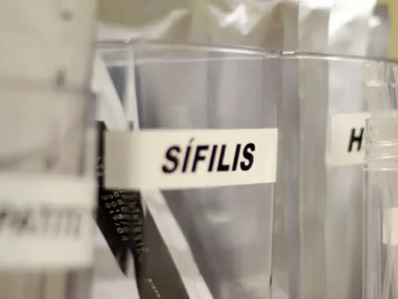 Sífilis continua em ritmo acelerado de crescimento no país